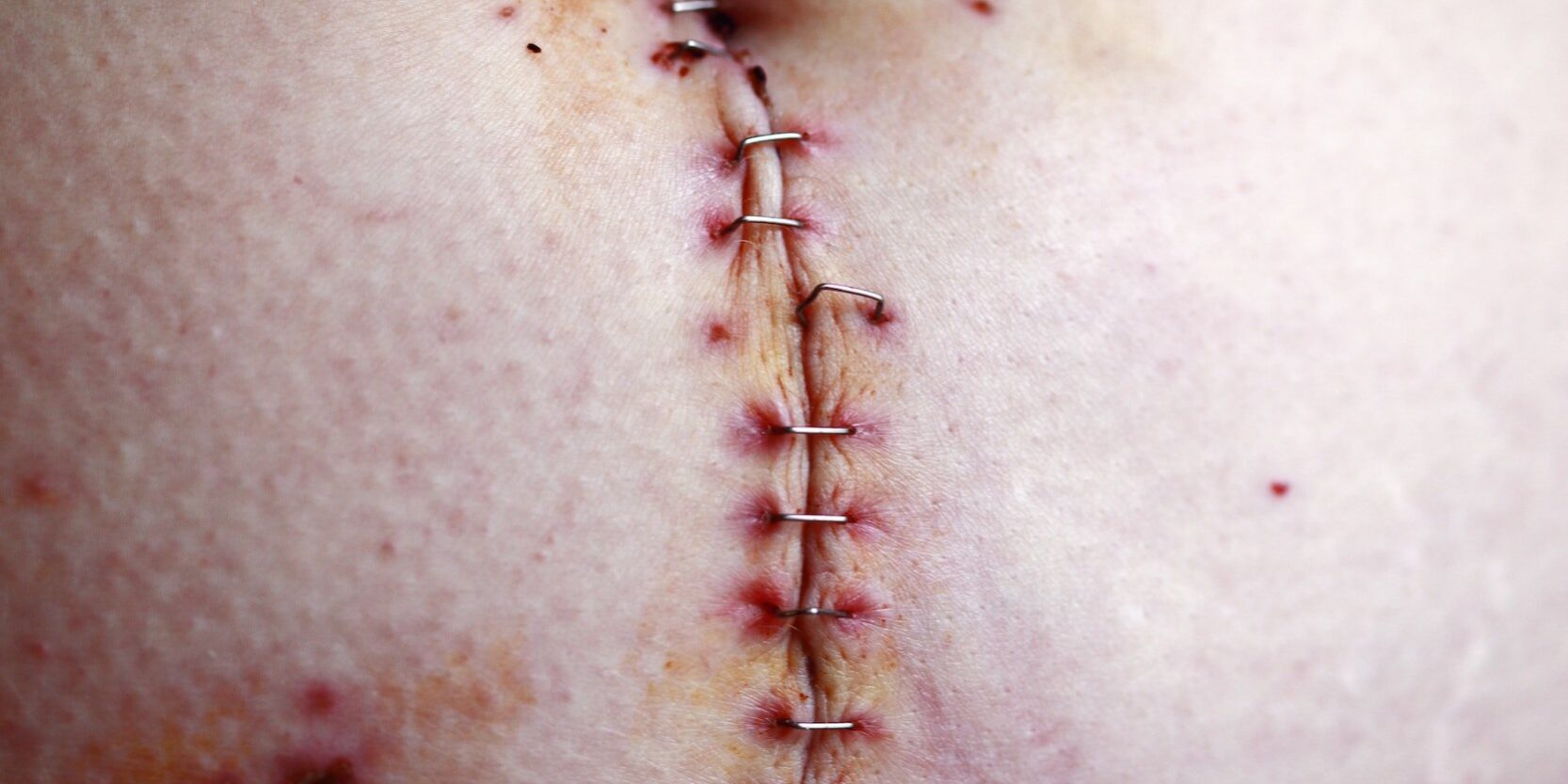 attachment-60422102c15d572cde0e0621